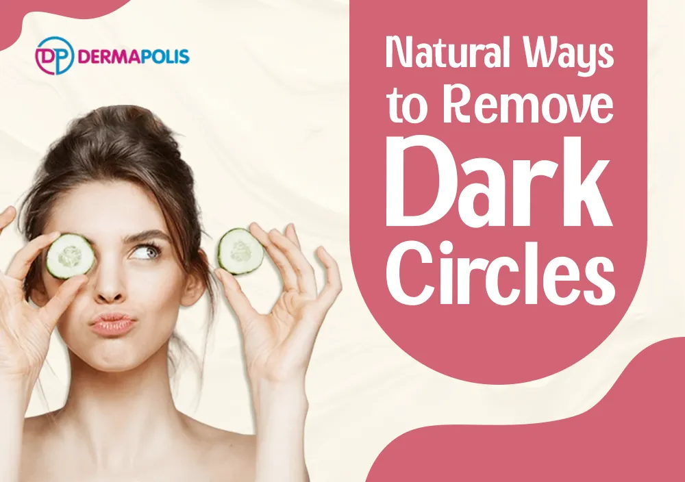 Natural Ways To Remove Dark Circles