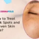 How to Treat Dark Spots and Uneven Skin Tone_ 80x80