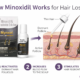How Minoxidil Works for Hair Loss 80x80